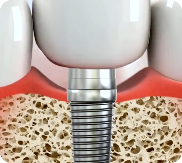 Dental Care 1