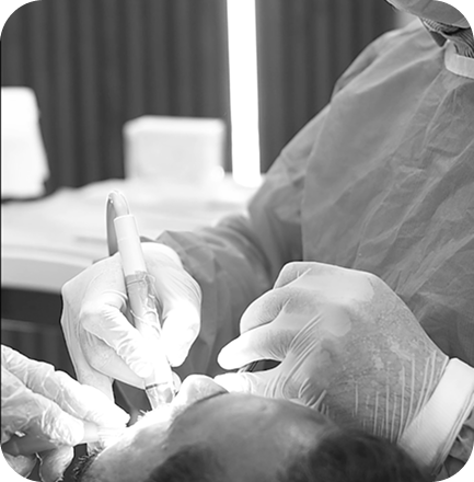 Root Canal