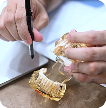 Root Canal