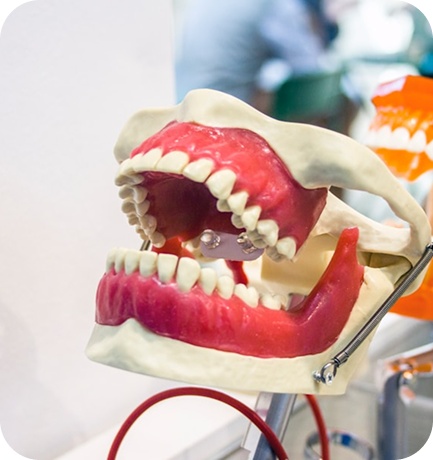 The aligner treatment process