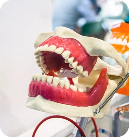 The aligner treatment process