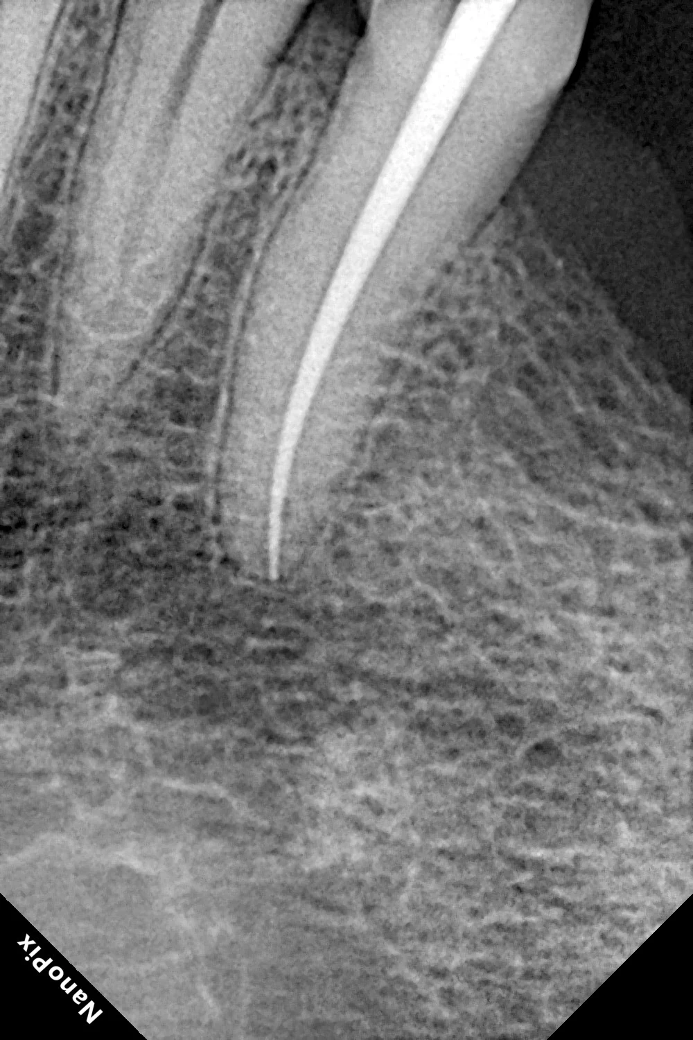 Root Canal Cost in Gujranwala: Complete 2026 Price Guide — image 2