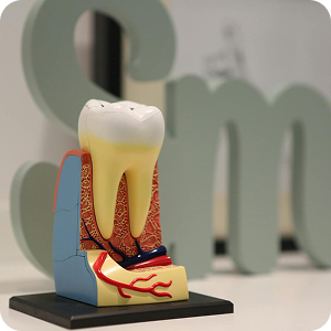 The root canal process