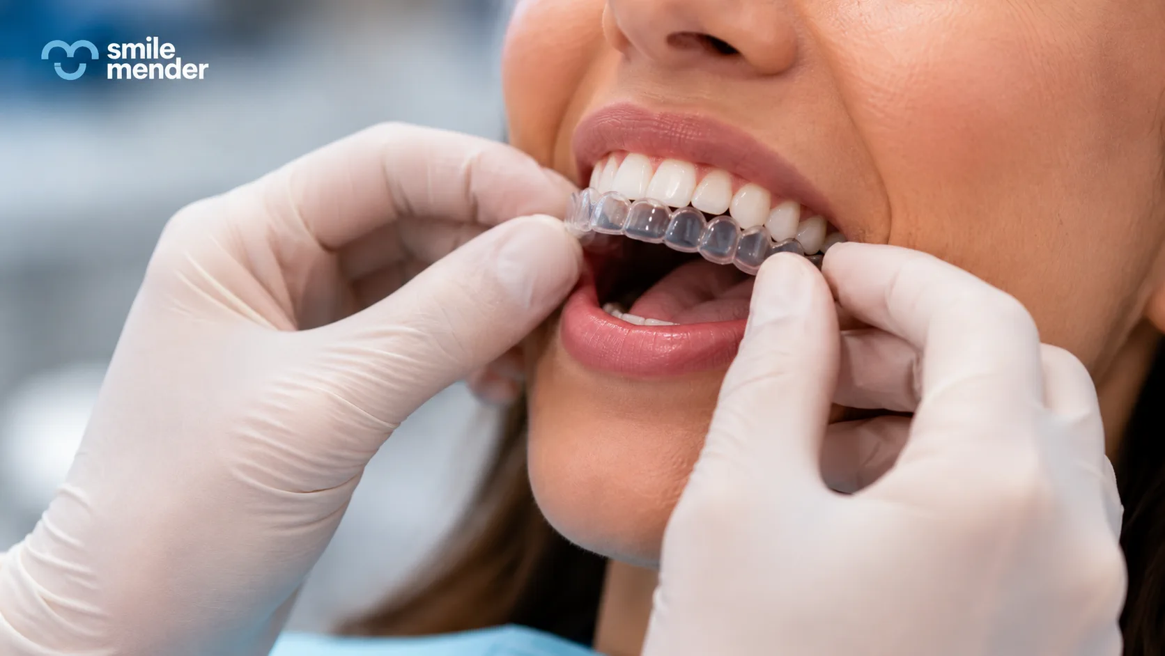 Aligners
