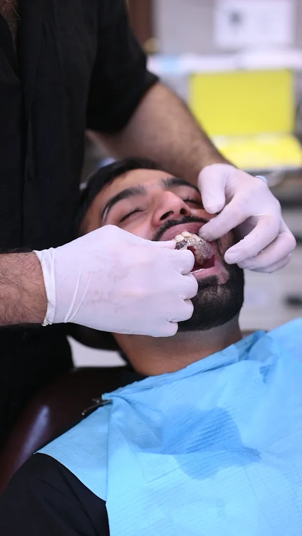 Dentist fitting a clear aligner tray onto a patient's upper teeth at Smile Mender, Gujranwala