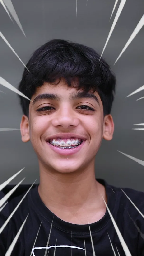 Smiling teenage boy showing his metal braces